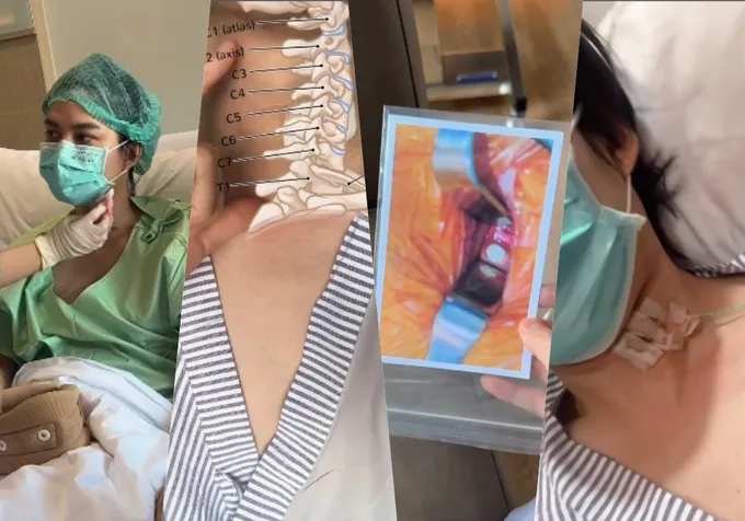"กอล์ฟ พิชญะ" โพสต์คลิปผ่าตัดด่วน หลังพบน้ำข้นๆสีขาวๆเกาะตรงกระดูกคอ มีโอกาสลามไปปอดติดเชื้อในเลือด