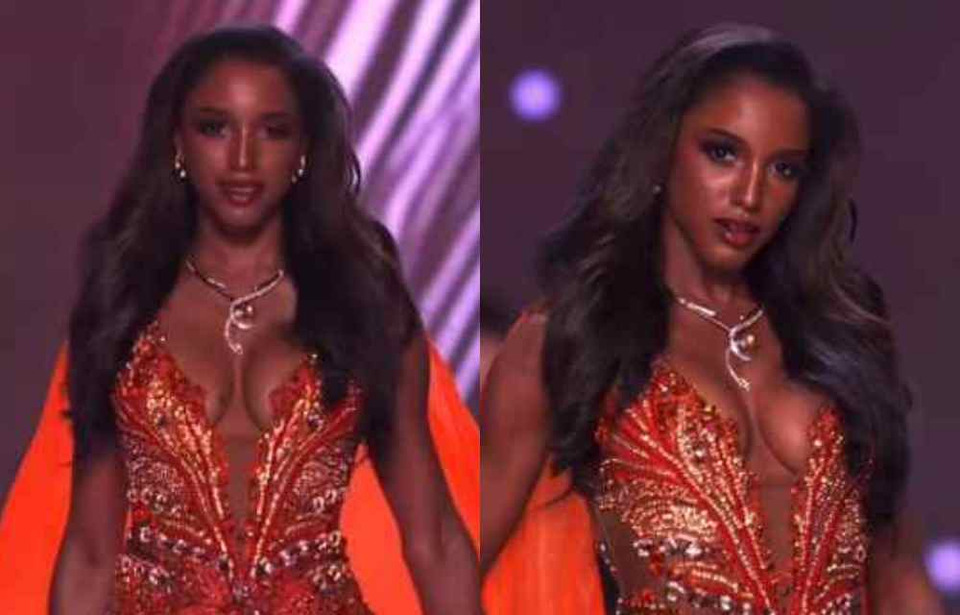 อัปเดตอาการล่าสุด มิสยูนิเวิร์สจาไมกา ตกเวทีรอบพรีลิมฯ MU74 ปลอดภัยแล้ว