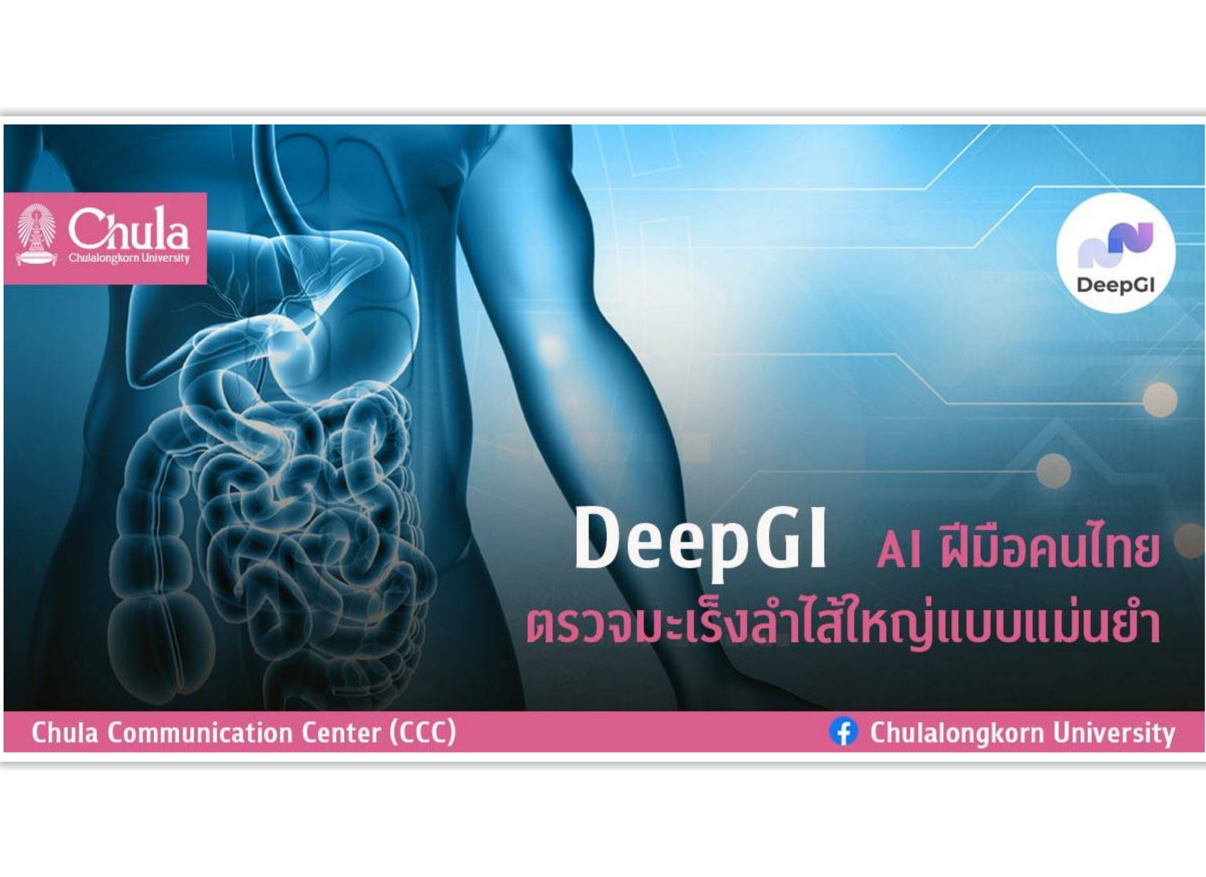 จุฬาฯคิดค้น“DeepGI” เอไอฝีมือคนไทย       ตรวจมะเร็งลำไส้ใหญ่แบบแม่นยำ
