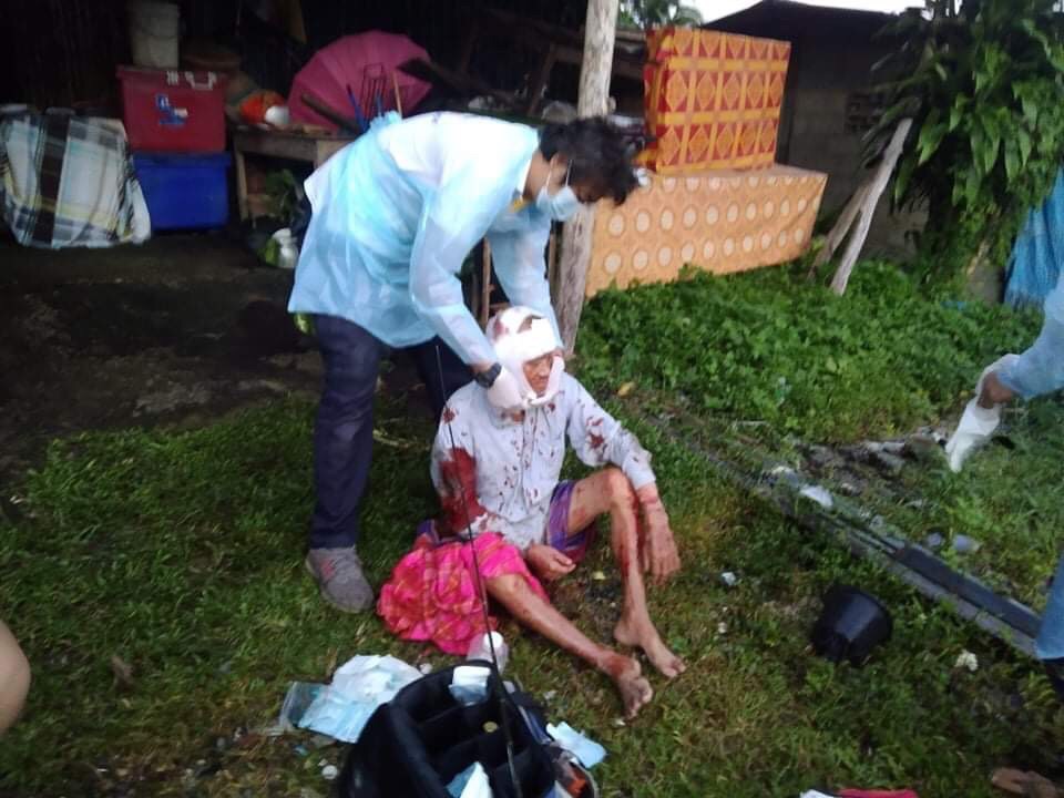 ลุงเมาเหล้า หาเรื่องเพื่อนบ้าน ใช้ฉมวกแทงปลาเสียบ พลเมืองดีเข้าช่วยเหลือทัน