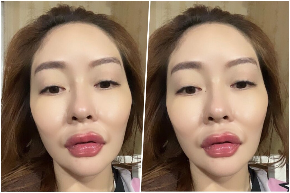สวยไม่เหมือนเดิม! 'แก้มบุ๋ม' กับเทรนด์ปากฉ่ำวาว