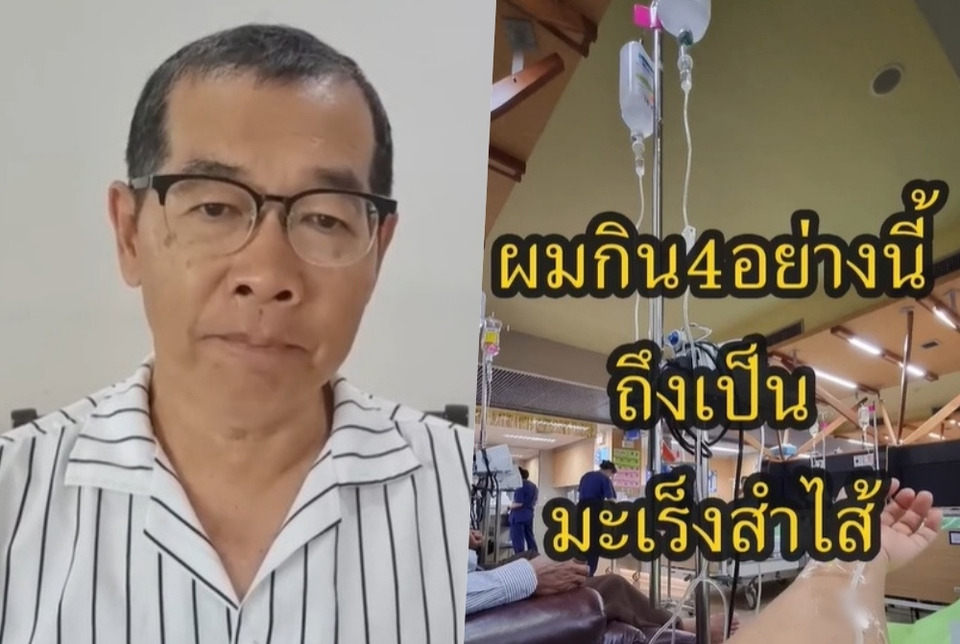 เลี่ยงได้เลี่ยง! แชร์ประสบการณ์กินของ 4 อย่าง เสี่ยงมะเร็งลำไส้