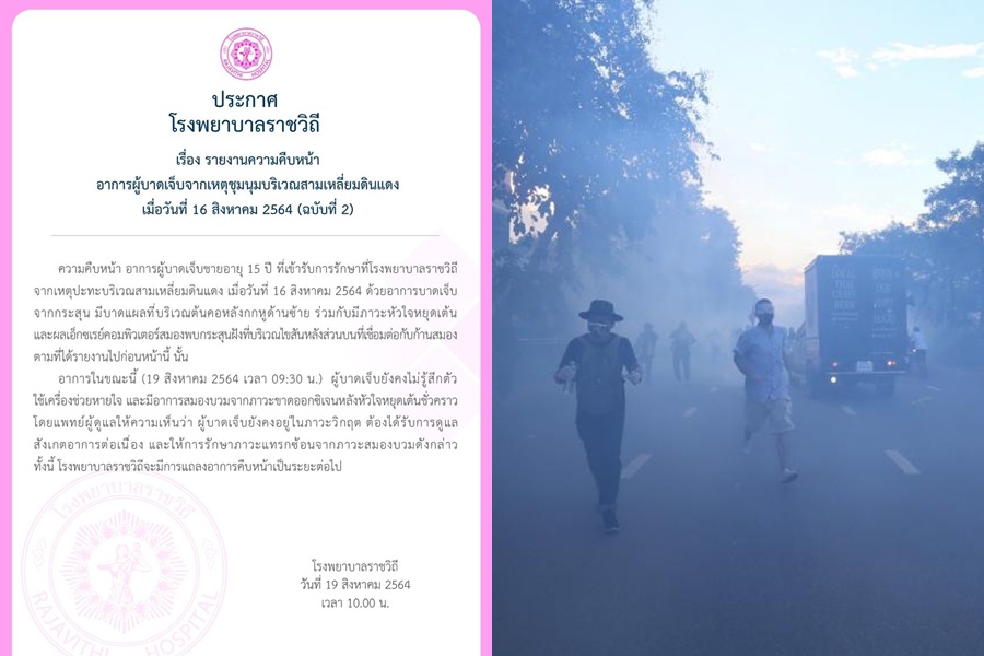 รพ.ราชวิถี แถลงอาการล่าสุดเด็กอายุ 15 ถูกยิงในม็อบ ยังวิกฤติ-ไม่รู้สึกตัว