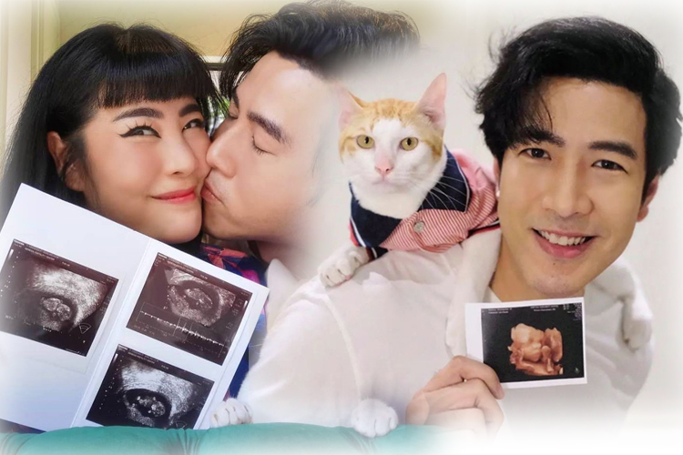 'โย่ง อาร์มแชร์'  โชว์ภาพอัลตราซาวด์ทายาทคนแรกยิ้มหวานให้หลังครบ 32 สัปดาห์ 