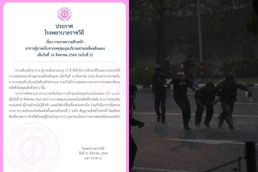 รพ.ราชวิถีอัพเดต!เด็ก 15 ปีถูกยิงในม็อบ     สมองบวมลด มีอาการอัมพาต ยังอยู่ ICU 