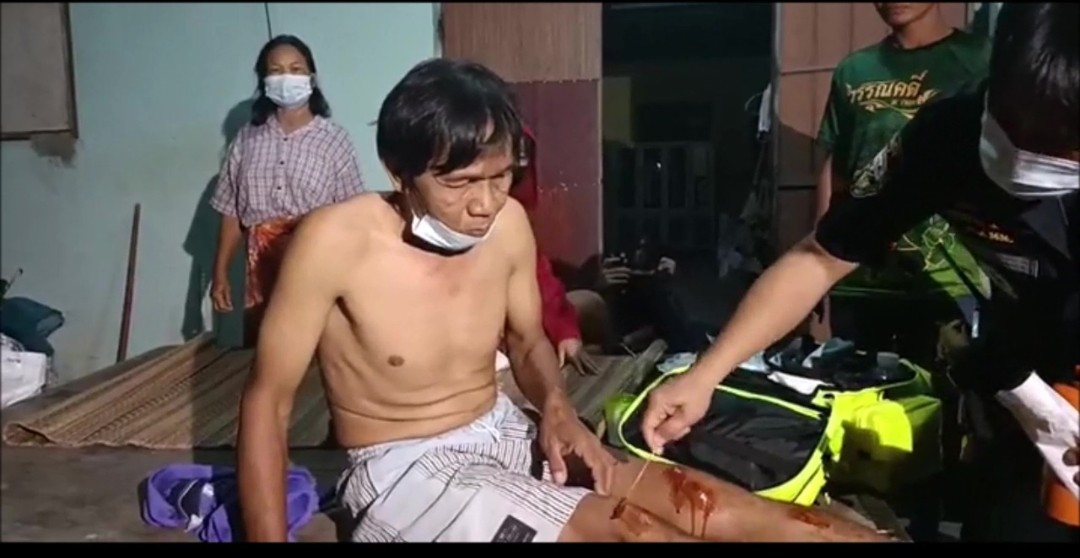 พี่เขยหนีตายระทึก น้องเมียหลอนมีดจี้คอหลังจุดประทัดแล้วเกิดไฟไหม้บ้าน​ กระโดดรถหนีตาย​  ญาติเชื่อตกใจกลัว