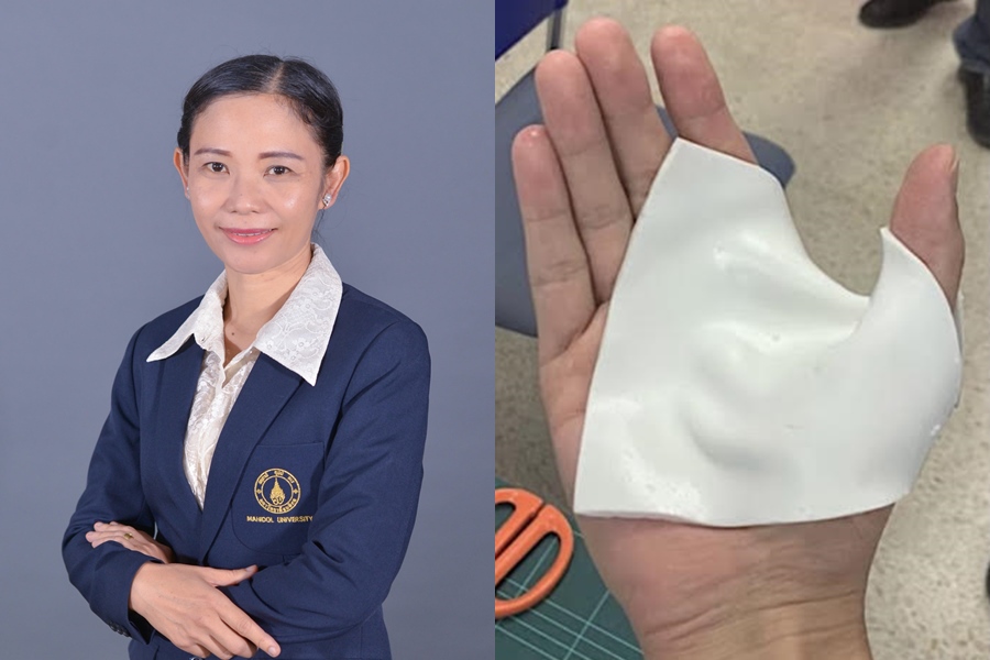 ม.มหิดล คิดค้นนวัตกรรมอุปกรณ์ดาม (Splint) เทอร์โมพลาสติกฝีมือคนไทย 