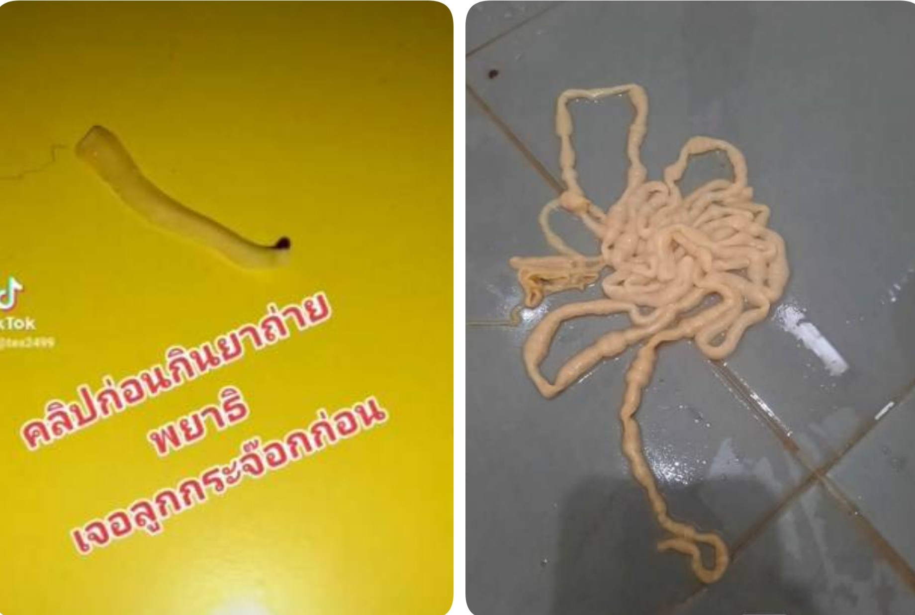 อวสาน ซอยจุ๊ หนุ่มรีวิวเตือนภัยชอบกินดิบ ชีวิตเสี่ยงตายกินยาถ่าย​ เจอสิ่งมีชีวิตยาวกว่า 2 เมตร