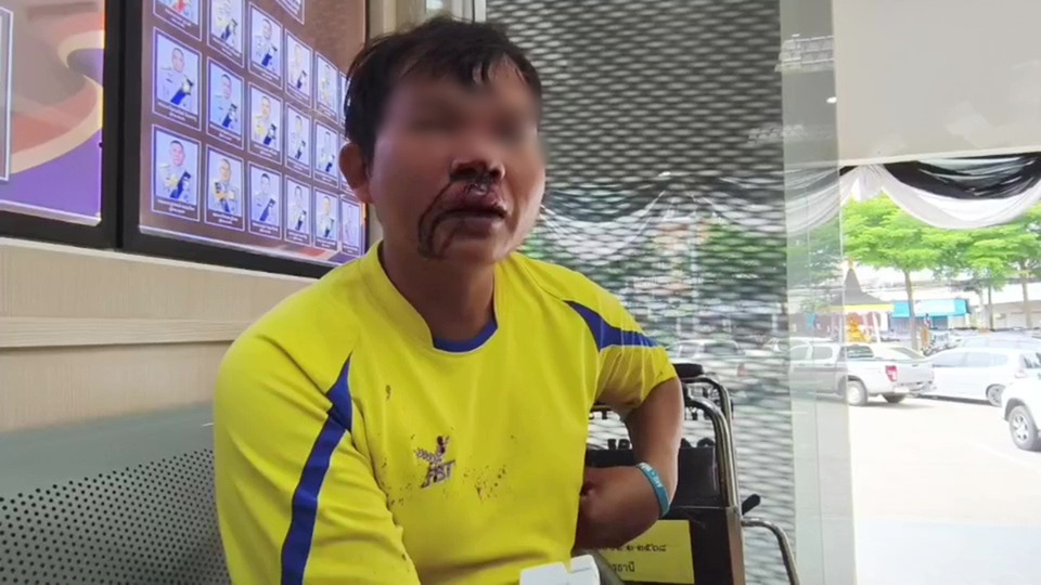 แก๊งเงินกู้นอกระบบโหด! รุมยำหนุ่มอุดรฯ หน้าปูดเลือดอาบ เหตุค้างส่งหนี้ 4 พัน