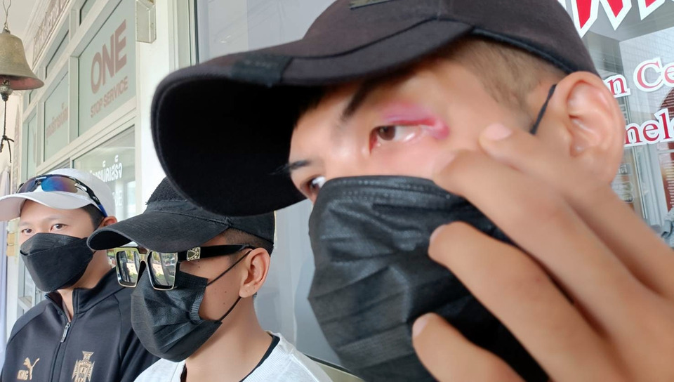 การ์ด “ระยองลองบีช” แจ้งความโต้ ยันถูกนักเที่ยวชกเจ็บ ปมคลิปว่อนรุมทำร้ายกลางงาน