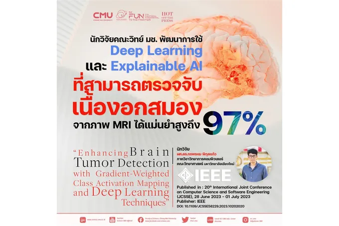 "มช." พัฒนาการใช้ Deep Learning และ Explainable AI สามารถตรวจจับเนื้องอกในสมองได้แม่นยำสูงถึง 97%