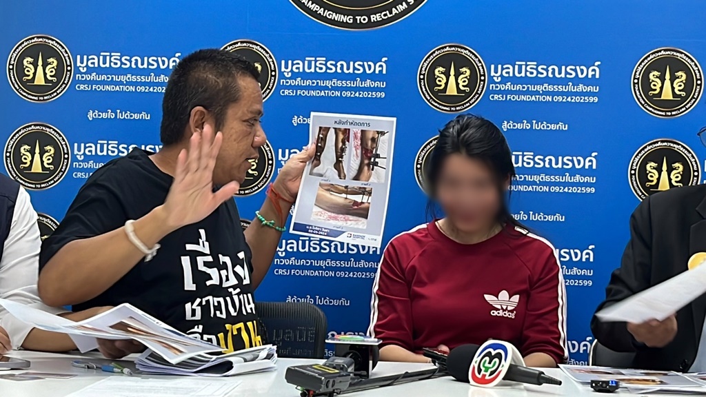 แม่ลูกสองร้องมูลนิธิ ถูกเลื่อยไฟฟ้าตัดขาขาด 2 ข้าง แต่ประกันเบี้ยวจ่ายเงิน