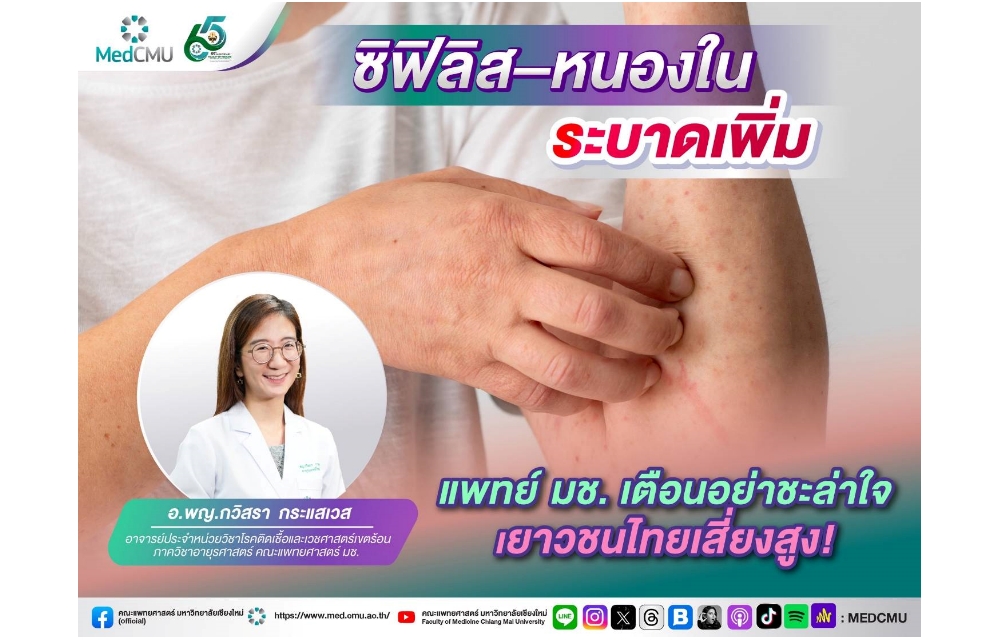 ซิฟิลิส–หนองใน ระบาดเพิ่ม แพทย์ มช. เตือนอย่าชะล่าใจ เยาวชนไทยเสี่ยงสูง!