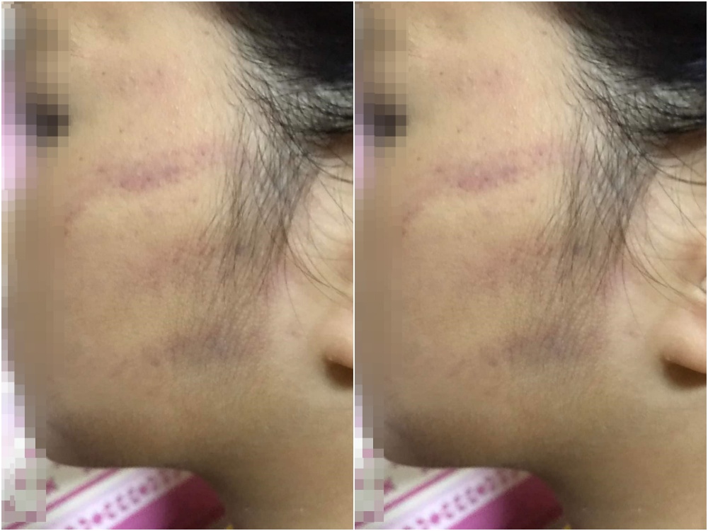 ชาวเน็ตจี้ไล่ออก!! เพจดัง แฉภาพครูตบหน้านักเรียนเป็นรอยนิ้วมือ