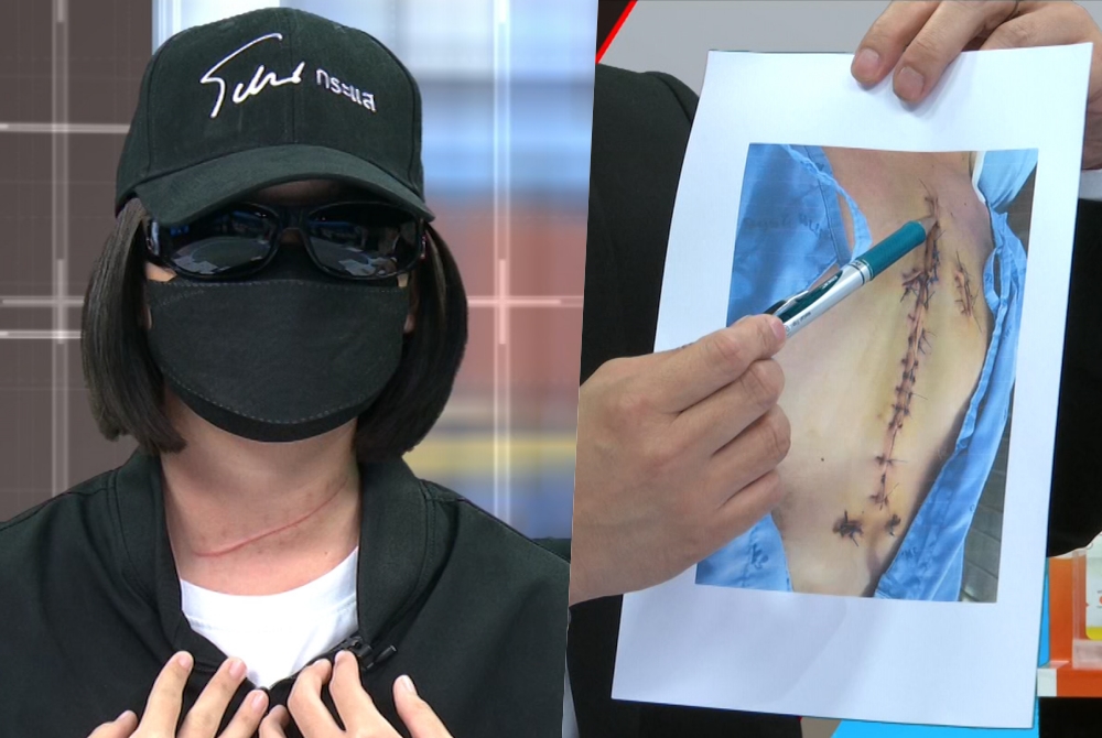 เปิดแผลสาวถูกหนุ่มง้อโหด มีดปาดคอแทงขั้วหัวใจรอดตายปาฏิหาริย์  