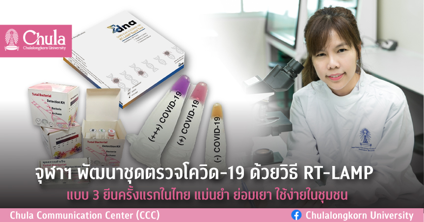 จุฬาฯ พัฒนาชุดตรวจโควิดด้วยวิธี RT-LAMP แบบ 3 ยีน    ครั้งแรกในไทย แม่นยำ ย่อมเยา ใช้ง่าย
