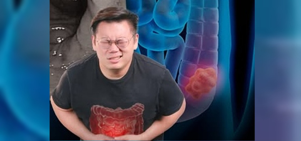 "หมอเจด"เตือน! อาการมะเร็งลำไส้ไม่จำเป็นต้องปวดท้อง–ถ่ายเป็นเลือด 