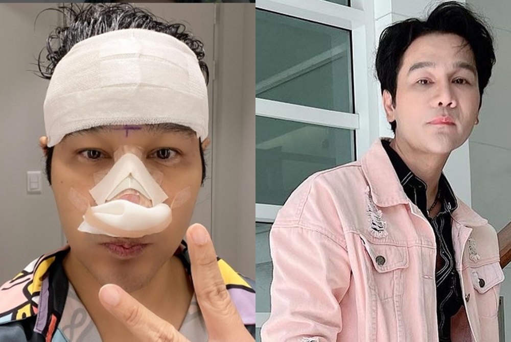 "กอล์ฟ เบญจพล" บินเกาหลีเสริมหล่อรอบที่ 3  เตือนแฟนคลับนักบูลลี่