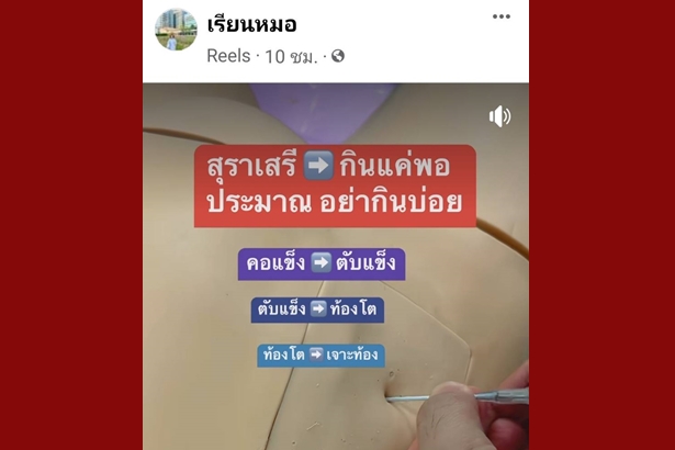 เพจเรียนหมอเตือน "สุราเสรี" กินแค่พอประมาณ เสี่ยง 3 โรค