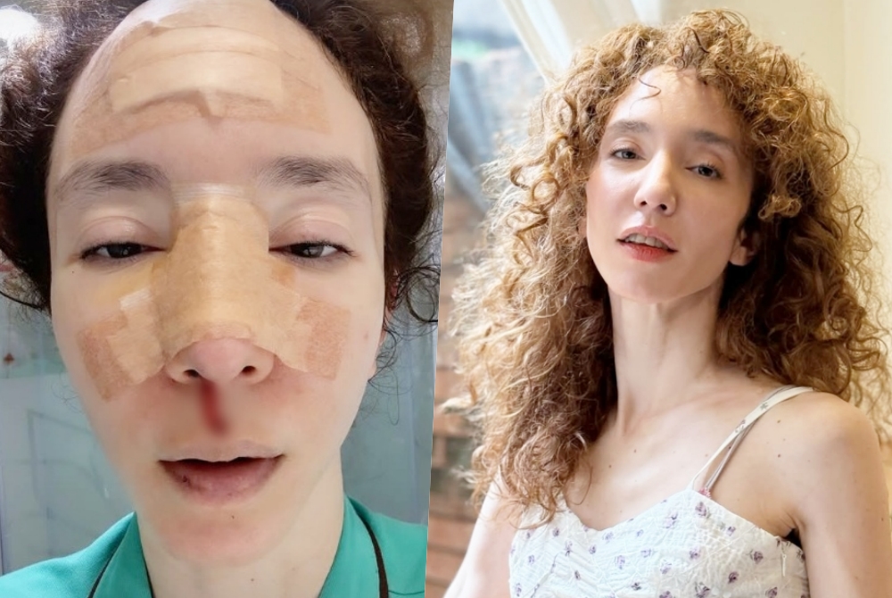 เจ็บแต่ใจสู้! “คลาวเดีย” เปิดภาพหลังผ่าตัด ลั่นฟาดเคราะห์ 