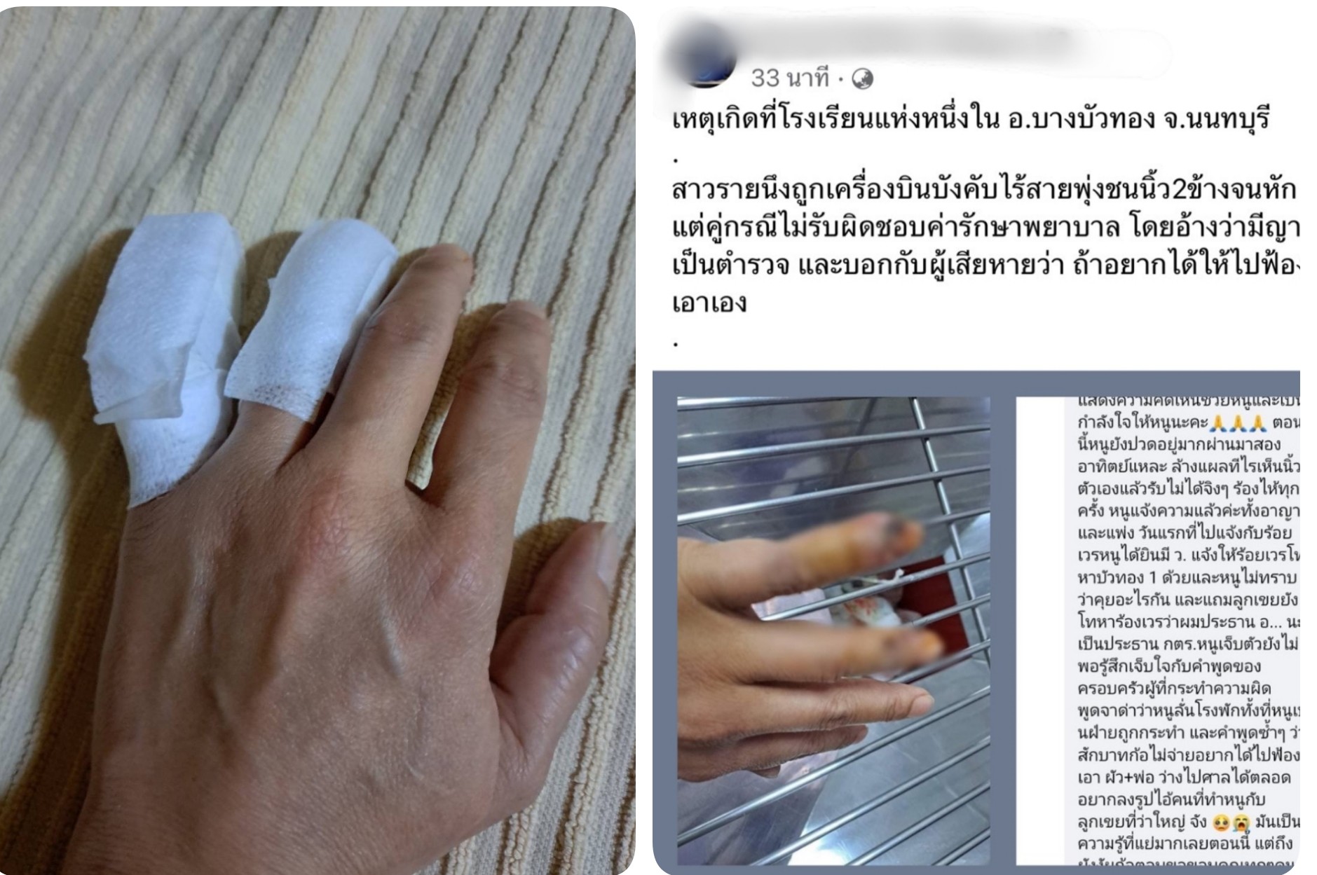 สาววัย 48 ร้องส.ส.พรรคก้าวไกล ถูกเครื่องบินบังคับชนนิ้วหัก คู่กรณีอ้างลูกชายเป็นตำรวจ
