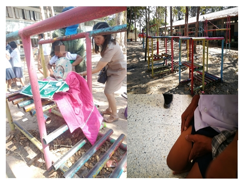 อุทาหรณ์ ดช.5 ขวบพลัดตกขาติดร่องสะพานเหล็กทรงตัว​ สนามเด็กเล่นในรร. 