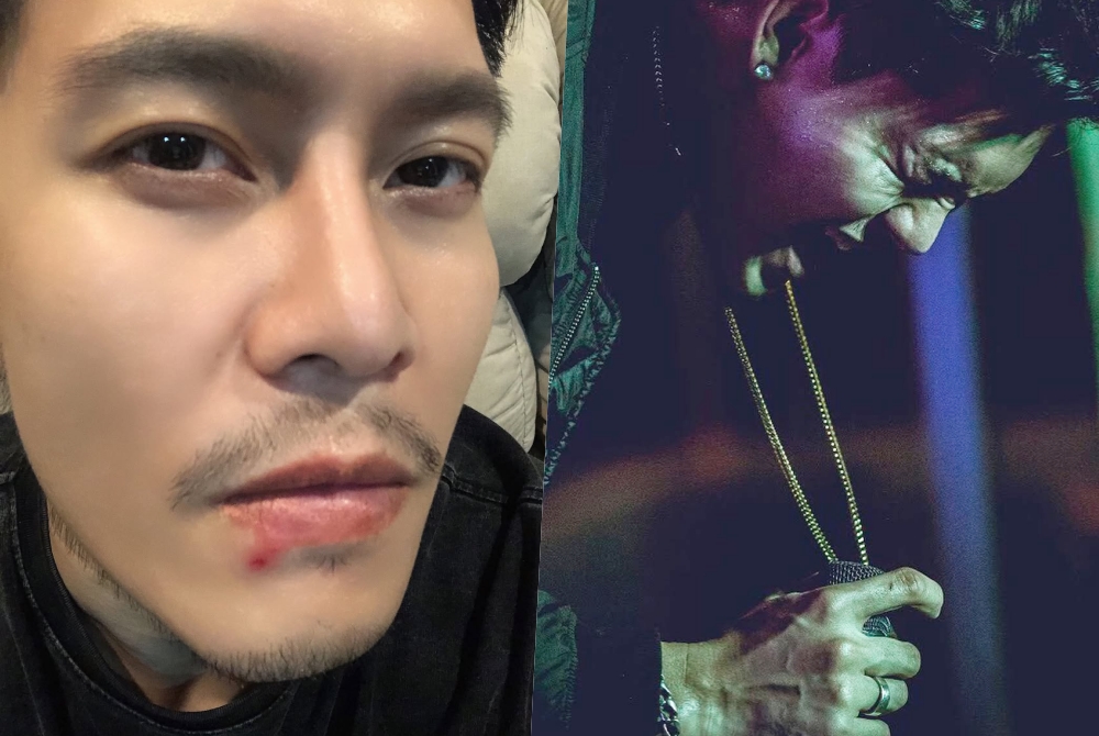 "ดิว เดอะสตาร์ 4" ติดเชื้อต่อมน้ำเหลืองอักเสบหลังใช้ไมค์สาธารณะ