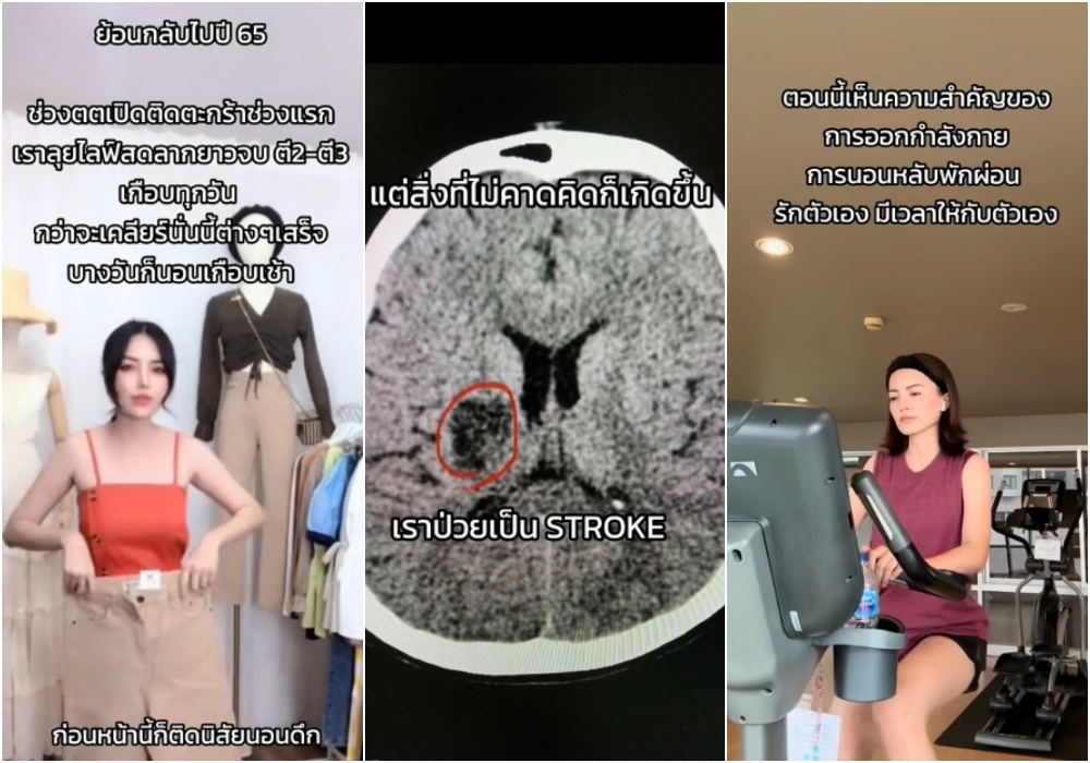 สาวเล่าถึงบทเรียนราคาแพง อายุ 38 มือซ้ายไม่สามารถใช้งานได้