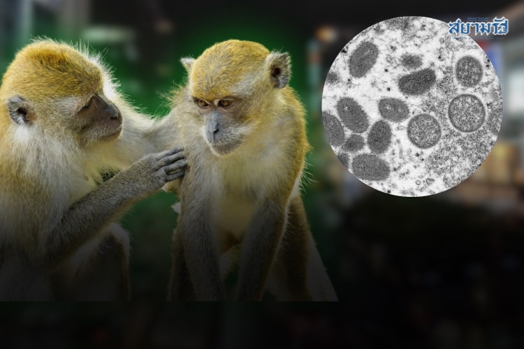 ชมสด! กรมควบคุมโรค พบผู้ป่วยสงสัยฝีดาษวานร clade 1 รายแรกในไทย 
