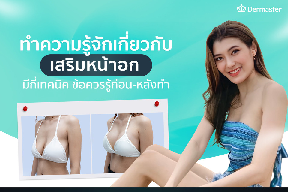 เสริมหน้าอกคืออะไร มีกี่เทคนิค? ดูข้อควรรู้ก่อนและหลังเสริมหน้าอก