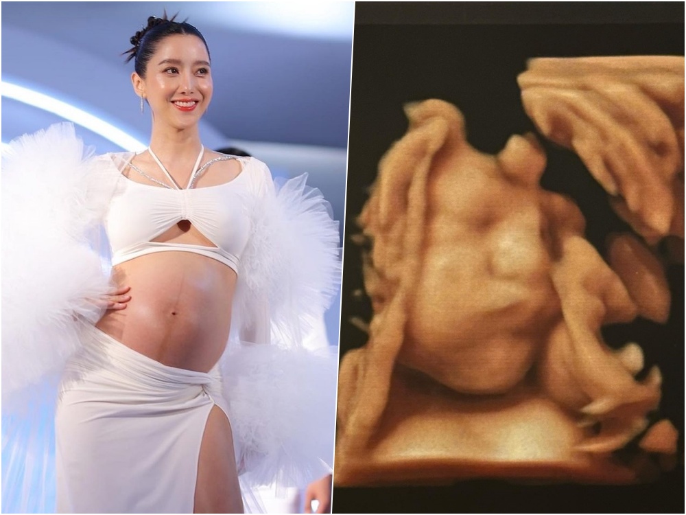 "ว่าที่คุณแม่ไอซ์" อวดภาพอัลตราซาวด์ลูก 8 เดือน แถมบอกรอเจอตัวจริง