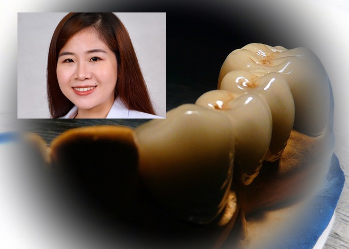 “ฟันตาย” ภัยร้าย!ในช่องปาก
