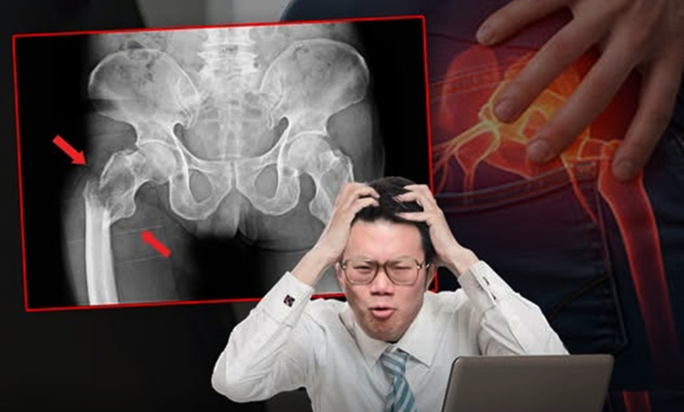 รู้ยัง! "หมอเจด" ชี้นั่งนานไม่ได้แค่ปวดหลัง แต่กระดูกสะโพกบางไม่รู้ตัว