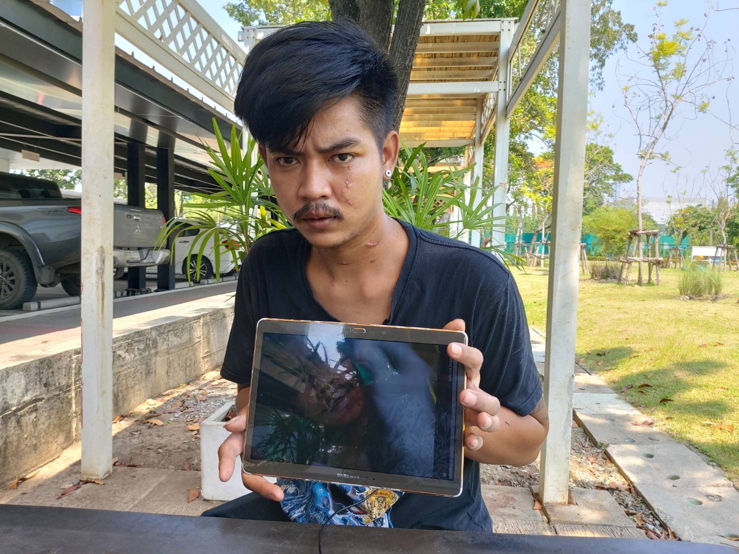 ช่างเฟอร์นิเจอร์ วอนตร.วังน้อยเร่งรัดจับกลุ่มชายฉกรรจ์รุมยำหวิดดับคาร้านโอเกะ