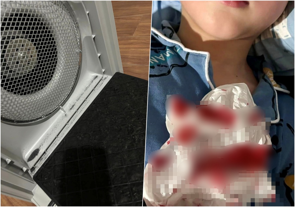  แม่โพสต์ อยู่เชียงใหม่ ฝุ่นพิษ PM 2.5 ยังวิกฤติ! ลูกเลือดกำเดาไหล เครื่องฟอกอากาศ เอาไม่อยู่