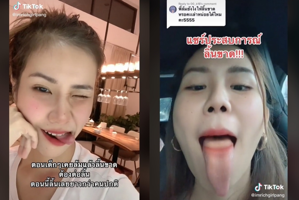 แห่แชร์! สาวลิ้นยาวกว่าคนปกติ เผยเคยลิ้นขาดแต่หมอต่อได้ทัน 
