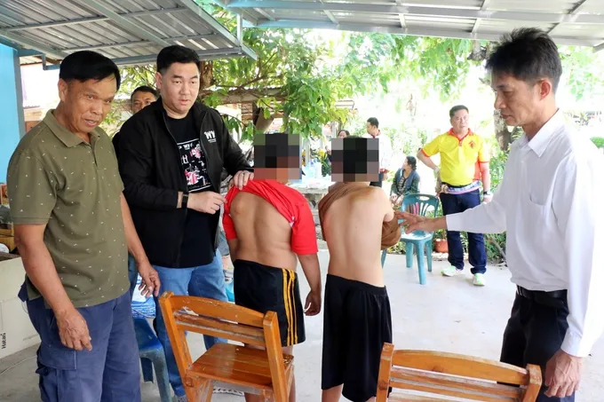 กาฬสินธุ์ลุยช่วยเด็ก ป.5 ถูกครูตีหลังช้ำ 11 คน ผอ.เขตฯ สั่งย้ายครูออกนอกพื้นที่