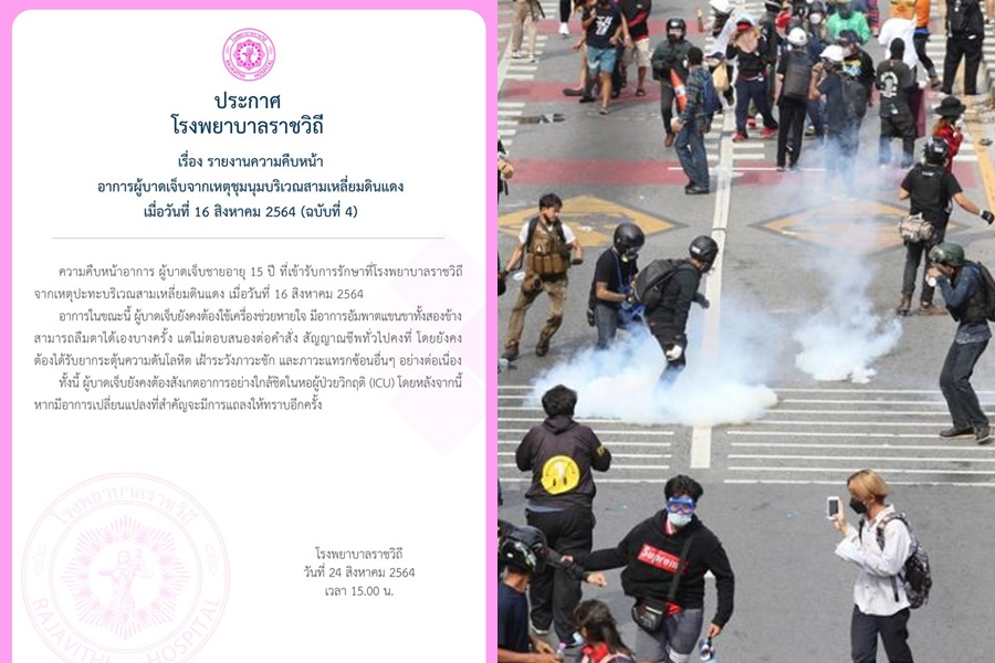 รพ.ราชวิถีแถลงอาการเด็ก 15 ปี ลืมตาได้แต่ไม่ตอบสนอง      ยังต้องเฝ้าระวังใน ICU ใกล้ชิด