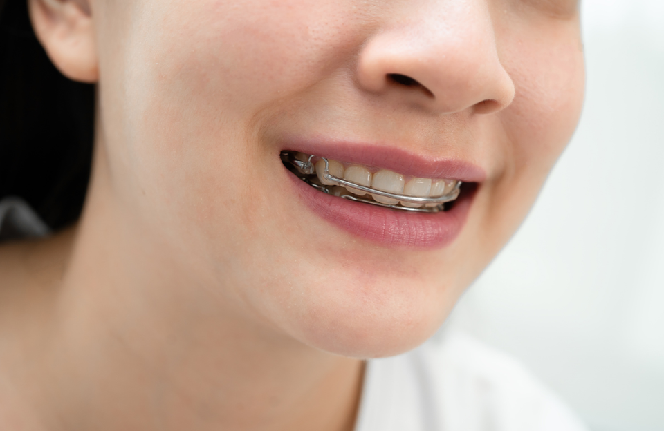  สาเหตุที่ทำให้ฟันล้ม