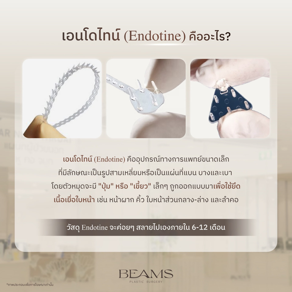 หมุดเอนโดไทน์ คืออะไร